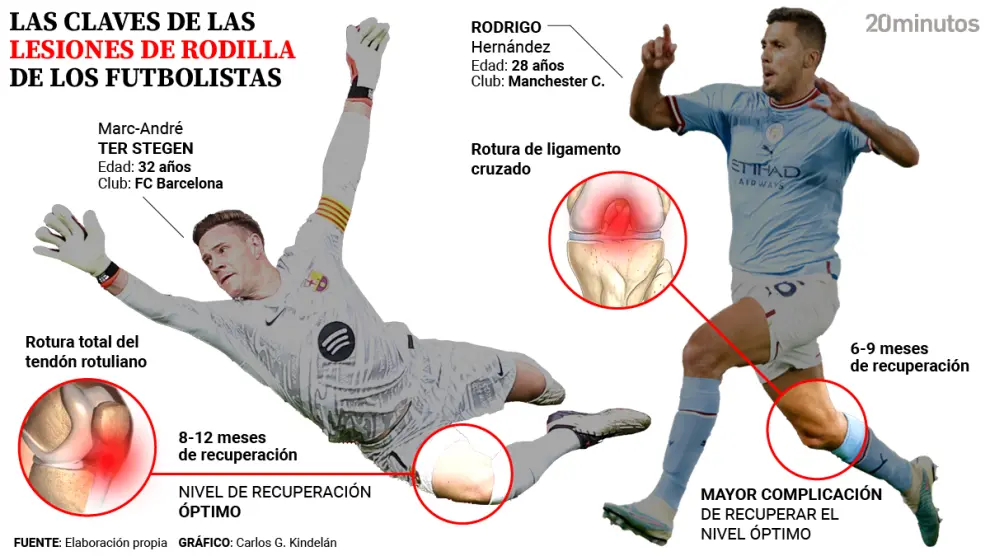 Especialistas médicos explican el impacto de las lesiones de rodilla en el fútbol