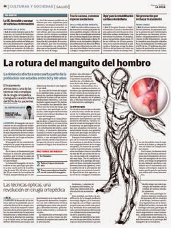 La rotura del manguito del hombro